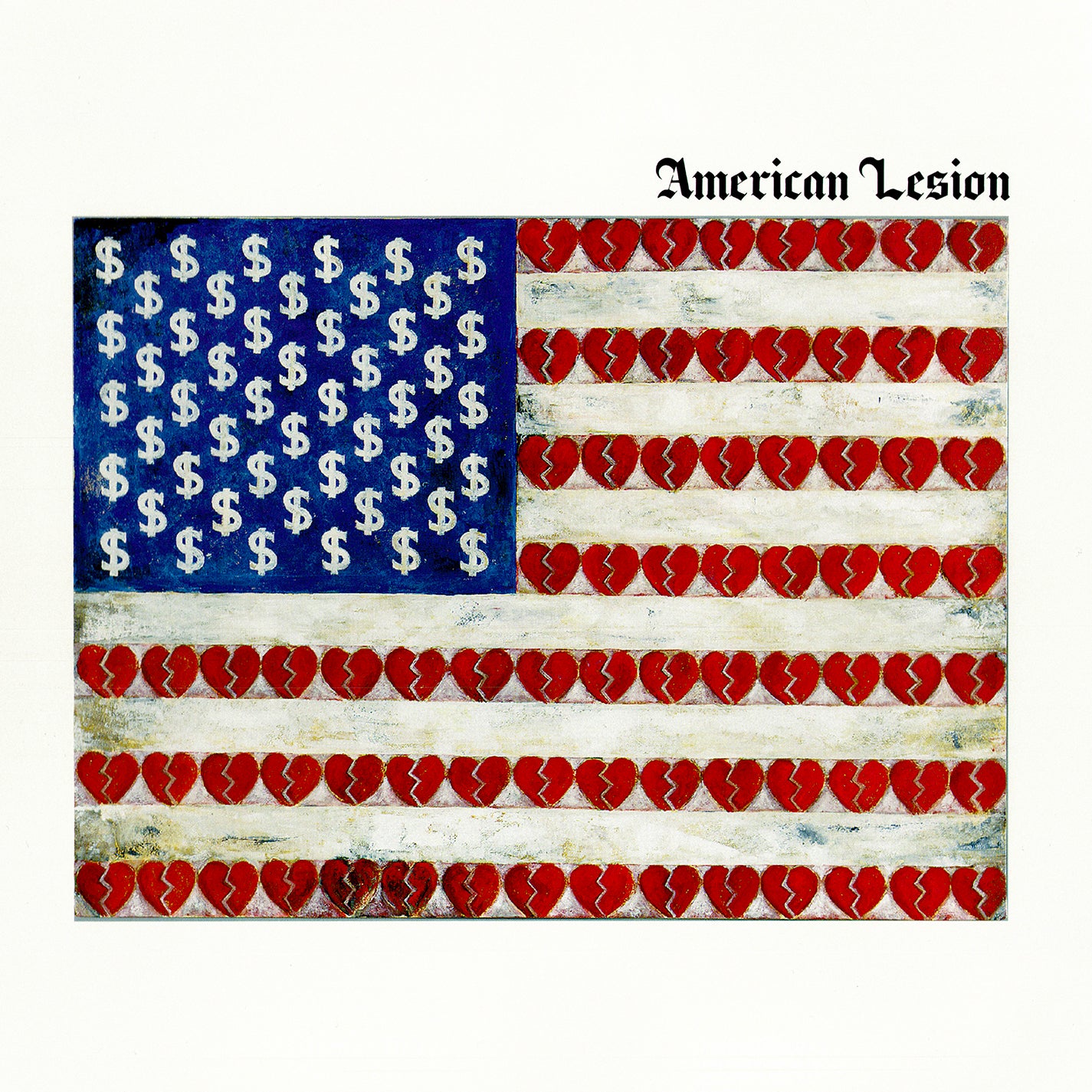 American Lesion - LP